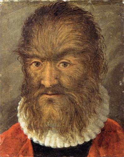The "Hairy Man from Munich"