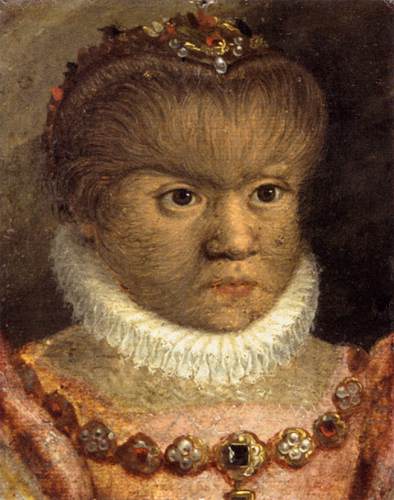 The Daughter of the "Hairy Man from Munich"