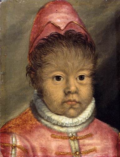 The Son of the "Hairy Man from Munich"