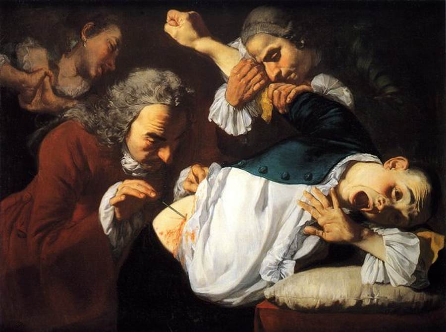 The Operation (The Wound)